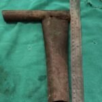 सीटी स्कैन में सामने आई गंभीरता