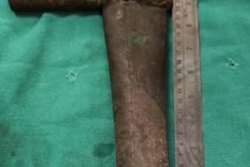 सीटी स्कैन में सामने आई गंभीरता